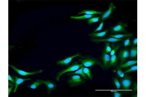 Immunofluorescence of purified MaxPab antibody to TNK2 on HeLa cell. (TNK2 抗体  (AA 1-352))