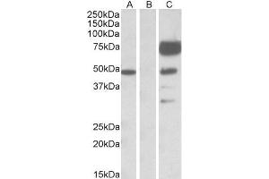 HEK293 lysate (10ug protein in RIPA buffer) overexpressing Human ANGPT1 with DYKDDDDK tag probed with ABIN768552(1ug/ml) in Lane A and probed with anti- DYKDDDDK Tag (1/1000) in lane C. (Angiopoietin 1 抗体  (Internal Region))
