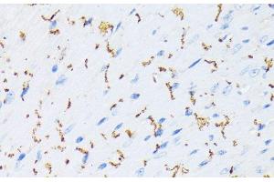 Immunohistochemistry of paraffin-embedded Mouse heart using Phospho-GJA1(S368) Polyclonal Antibody at dilution of 1:200 (40x lens). (Connexin 43/GJA1 抗体  (pSer368))