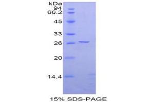 SDS-PAGE analysis of Rat Ephrin A4 Protein. (EFNA4 蛋白)
