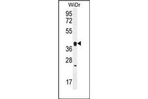 Western Blotting (WB) image for anti-Olfactory Receptor, Family 2, Subfamily T, Member 8 (OR2T8) (AA 248-277), (C-Term) antibody (ABIN953844)
