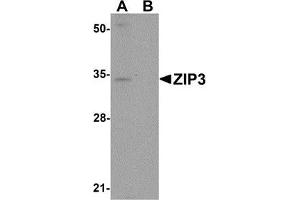 Western blot analysis of ZIP3 in mouse lung tissue lysate with ZIP3 antibody at 1 μg/ml in (A) the absence and (B) the presence of blocking peptide.