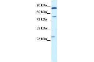 WB Suggested Anti-CLIC6 Antibody Titration:  0. (CLIC6 抗体  (Middle Region))