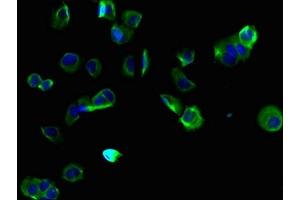 Immunofluorescent analysis of MCF-7 cells using ABIN7173179 at dilution of 1:100 and Alexa Fluor 488-congugated AffiniPure Goat Anti-Rabbit IgG(H+L) (TMEM255B 抗体  (AA 221-356))