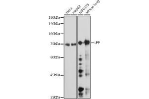 Western blot analysis of extracts of various cell lines, using LPP antibody (ABIN7268284) at 1:1000 dilution. (LPP 抗体)