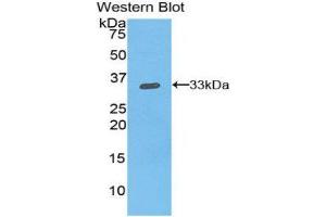 Western Blotting (WB) image for anti-Integrin beta 1 (ITGB1) (AA 454-714) antibody (ABIN1859501) (ITGB1 抗体  (AA 454-714))