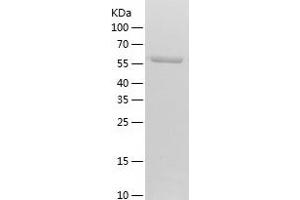 Western Blotting (WB) image for Pyruvate Kinase, Liver and RBC (PKLR) (AA 47-574) protein (His tag) (ABIN7124725) (PKLR Protein (AA 47-574) (His tag))