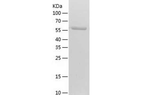 PKLR Protein (AA 47-574) (His tag)