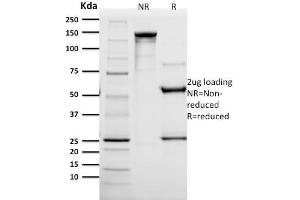 SDS-PAGE Analysis Purified HER-2 Mouse Monoclonal Antibody (SPM172).