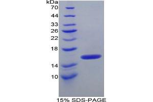 SDS-PAGE analysis of Human ITIH4 Protein. (ITIH4 蛋白)