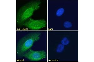 ABIN5539846 Immunofluorescence analysis of paraformaldehyde fixed U2OS cells, permeabilized with 0. (MMP 9 抗体  (Internal Region))