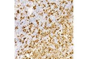 Immunohistochemistry of paraffin-embedded Human tonsil using CD74 antibody (ABIN7267759) at dilution of 1:100 (40x lens). (CD74 抗体)