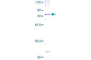 MAT2B Protein (AA 1-323) (GST tag)