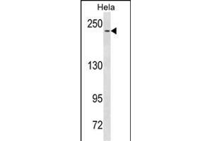 NOTCH3 Antibody  (ABIN1537680 and ABIN2843860) western blot analysis in Hela cell line lysates (35 μg/lane). (NOTCH3 抗体  (C-Term))