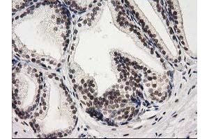 Image no. 1 for anti-Protein Kinase C, epsilon (PRKCE) antibody (ABIN1500229) (PKC epsilon 抗体)