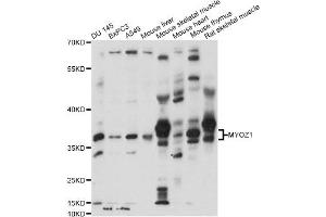 Western blot analysis of extracts of various cell lines, using MYOZ1 antibody (ABIN6290654) at 1:1000 dilution. (Myozenin 1 抗体)