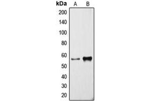 Western blot analysis of Cytochrome P450 3A4 expression in NCIH460 (A), human liver (B) whole cell lysates. (CYP3A4 抗体  (Center))