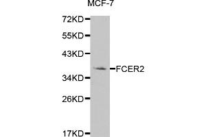 Western blot analysis of extracts of MCF-7 cells, using FCER2 antibody (ABIN5970939) at 1/1000 dilution. (FCER2 抗体)
