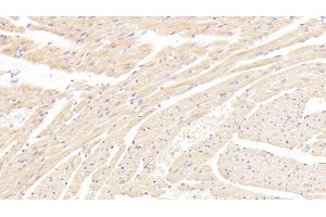 Detection of LEPR in Rat Cardiac Muscle Tissue using Polyclonal Antibody to Leptin Receptor (LEPR)