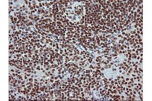 Image no. 7 for anti-Tripartite Motif Containing 38 (TRIM38) (AA 1-265) antibody (ABIN1490681)