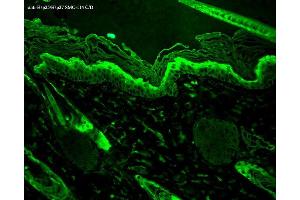 Immunohistochemistry (IHC) image for anti-Heat Shock 27kDa Protein 1 (HSPB1) antibody (FITC) (ABIN2481422)