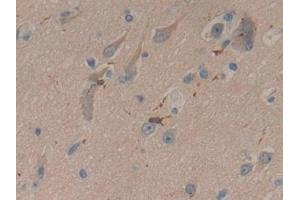 Immunohistochemistry (IHC) image for anti-Coronin, Actin Binding Protein, 1A (CORO1A) (AA 7-204) antibody (ABIN7436672)