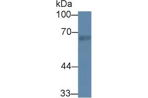 Western Blot; Sample: Rat Lung lysate; Primary Ab: 1µg/ml Rabbit Anti-Rat RTKN Antibody Second Ab: 0. (Rhotekin 抗体  (AA 296-548))