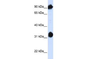 WB Suggested Anti-HSPA4 Antibody Titration:  0. (HSPA4 抗体  (N-Term))