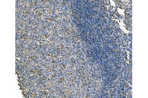 IHC analysis of NLRP7 using anti-NLRP7 antibody (ABIN7599027).