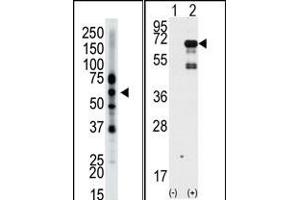 The anti-Epsin2 Pab (ABIN388977 and ABIN2839218) is used in Western blot to detect Epsin2 in mouse brain tissue lysate. (Epsin 2 抗体  (N-Term))