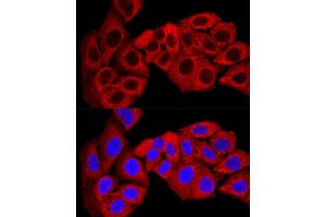 Confocal immunofluorescence analysis of U-2 OS cells using SQSTM1/p62 Polyclonal Antibody (ABIN6128552, ABIN6148419, ABIN6148425 and ABIN6223705) at dilution of 1:200. (SQSTM1 抗体  (AA 1-440))