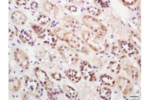 Formalin-fixed and paraffin embedded human kidney labeled with Anti-IGFBP1 Polyclonal Antibody, Unconjugated (ABIN734948) at 1:200 followed by conjugation to the secondary antibody and DAB staining (IGFBPI 抗体  (AA 150-250))