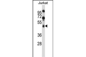 SPN/CD43 Antibody (Center) (ABIN658006 and ABIN2846949) western blot analysis in Jurkat cell line lysates (35 μg/lane). (CD43 抗体  (AA 230-257))
