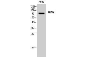 Western Blotting (WB) image for anti-Amyloid beta (A4) Precursor Protein-Binding, Family B, Member 1 Interacting Protein (APBB1IP) (Internal Region) antibody (ABIN3186762) (Amyloid beta (A4) Precursor Protein-Binding, Family B, Member 1 Interacting Protein (APBB1IP) (Internal Region) 抗体)