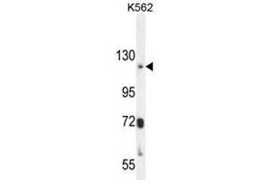 ATP8A2 Antibody (N-term) western blot analysis in K562 cell line lysates (35µg/lane). (ATP8A2 抗体  (N-Term))