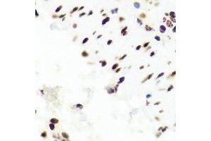 Immunohistochemistry (IHC) image for anti-Proteasome (Prosome, Macropain) 26S Subunit, Non-ATPase, 13 (PSMD13) antibody (ABIN7308240) (PSMD13 抗体)