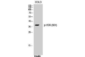 Western Blotting (WB) image for anti-Vitamin D Receptor (VDR) (pSer51) antibody (ABIN3182335) (Vitamin D Receptor 抗体  (pSer51))