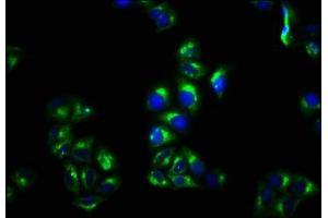 Immunofluorescence staining of Hela cells with ABIN7159461 at 1:100, counter-stained with DAPI. (CNNM4 抗体  (AA 589-691))