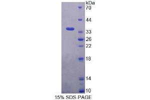 SDS-PAGE analysis of Mouse BAG4 Protein. (BAG4 蛋白)