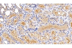 Immunohistochemistry (IHC) image for anti-Mitogen-Activated Protein Kinase 14 (MAPK14) (AA 19-279) antibody (ABIN7433252)