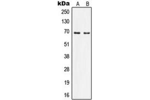 Western blot analysis of Nephrocystin 5 expression in Ramos (A), HeLa (B) whole cell lysates. (IQCB1 抗体  (Center))