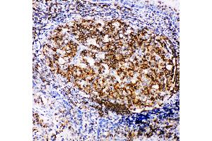 Anti-RIAM antibody, IHC(P) IHC(P): Human Tonsil Tissue (Amyloid beta (A4) Precursor Protein-Binding, Family B, Member 1 Interacting Protein (APBB1IP) (AA 647-666), (C-Term) 抗体)