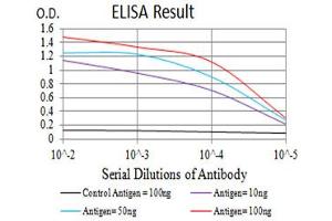 Black line: Control Antigen (100 ng),Purple line: Antigen (10 ng), Blue line: Antigen (50 ng), Red line:Antigen (100 ng) (P2RY12 抗体)
