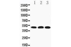 Anti-HYAL3 antibody, Western blotting Lane 1: 22RV Cell Lysate Lane 2: HELA Cell Lysate Lane 3: V20S Cell Lysate (HYAL3 抗体  (C-Term))