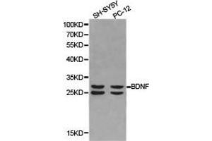 Western Blotting (WB) image for anti-Brain-Derived Neurotrophic Factor (BDNF) antibody (ABIN1871274) (BDNF 抗体)