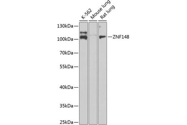 ZNF148 抗体  (AA 690-794)