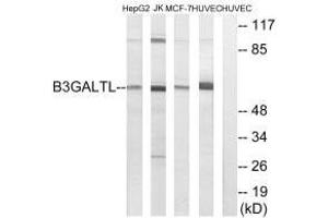 Western blot analysis of extracts from HepG2 cells, Jurkat cells, MCF-7 cells and HUVEC cells, using B3GALTL antibody. (B3GALTL 抗体  (C-Term))