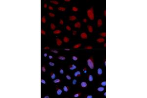 Immunofluorescence analysis of U2OS cells using TNNC1 antibody. (TNNC1 抗体)