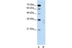 WB Suggested Anti-CD8B Antibody Titration:  0.