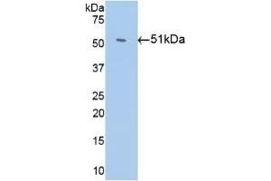 Detection of Recombinant Antithrombin, Human using Monoclonal Antibody to Antithrombin (AT) (SERPINC1 抗体)